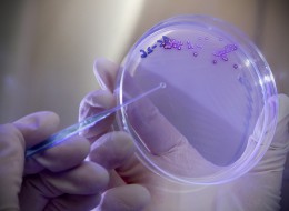 bacteria